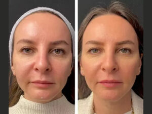 Best Plastic Surgeon in Dubai Shares Insight on Ethnic Rhinoplasty Techniques