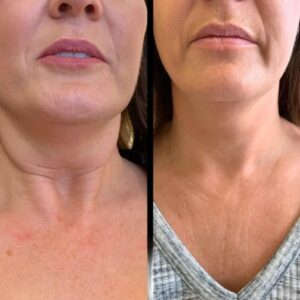 Best Plastic Surgeons in dubai