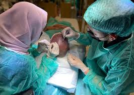 Understanding the Recovery Process After Hair Transplant in Dubai