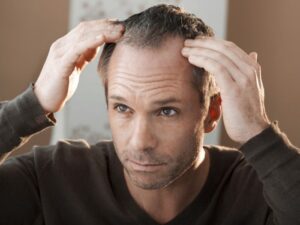 Effective Hair Transplants Riyadh