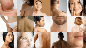 Private Online Dermatologist for Expert Virtual Skin Care Anytime