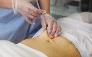 How Does Aqualyx Break Down Stubborn Fat Cells?