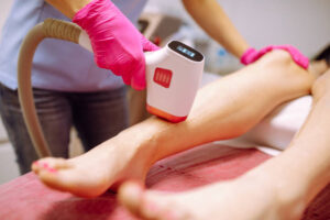 Laser Hair Removal Safety Tips for At-Home Devices