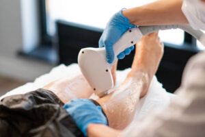 Riyadh’s Best Laser Hair Solutions