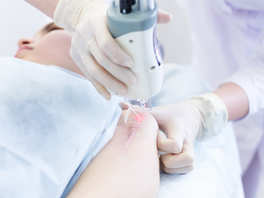 Laser Scar Removal Dubai Trusted Clinics & Surgeons