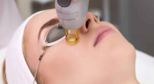 Laser Skin Tightening: Smooth, Firm Skin with AI Help
