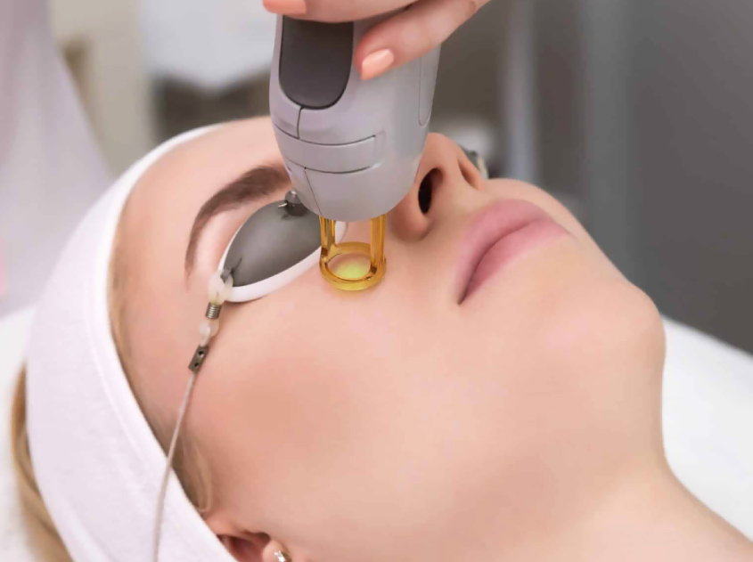 Laser Skin Tightening: Smooth, Firm Skin with AI Help