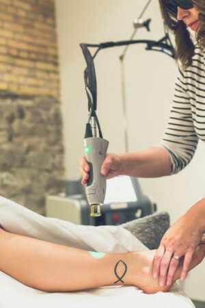 Common Side Effects of Laser Tattoo Removal and How to Manage Them