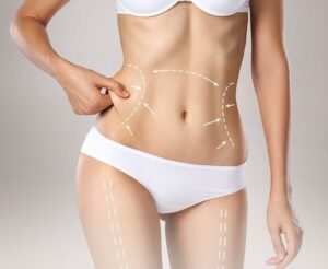 Riyadh Fat Removal Liposuction