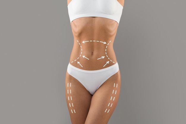 Riyadh Liposuction Packages