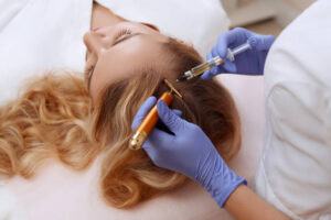 PRP Hair Treatment for Men and Women: Key Advantages