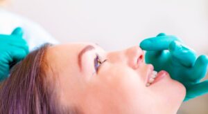 Rhinoplasty Before and After in Dubai