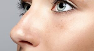 Rhinoplasty in Dubai: Step by Step Guide