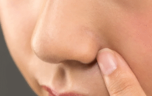 Rhinoplasty in Dubai for Natural Results