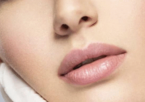 Russian Lips: Der beste Weg zu sinnlichen Lippen bei der SW BeautyBar Clinic