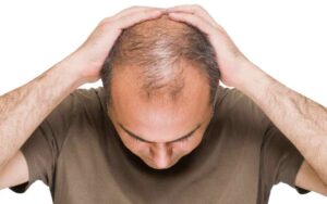 Hair Transplant Benefits for Thicker, Fuller, and Healthier Hair