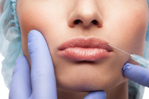How to Achieve Fuller Lips Safely with Best Lip Fillers Injections