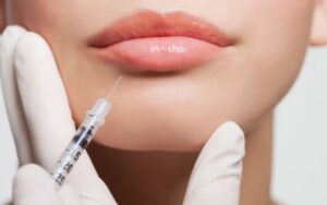 Safe and Effective Ways to Get Plump Lips with Best Lip Fillers Injections