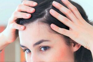 How Hair Transplant Offers a Permanent Fix for Hair Loss Problems