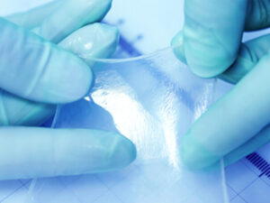 Amniotic Membrane Graft for Wounds: The Natural Solution for Advanced Healing