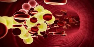 How Nutrition Plays a Key Role in Preventing Anemia Dubai: A Modern Perspective