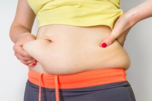 Tummy Tuck Benefits That Deliver a Slimmer Waistline Safely