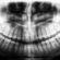 Panoramic Dental X-Ray