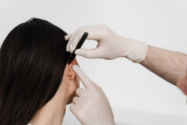 Ear Reshaping in Dubai: Expert Tips for Long-Lasting Change
