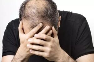 Is Best PRP Hair Treatment the Right Choice for Hair Loss Relief