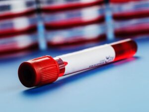 Know Your Health Anytime with a Blood Test at Home