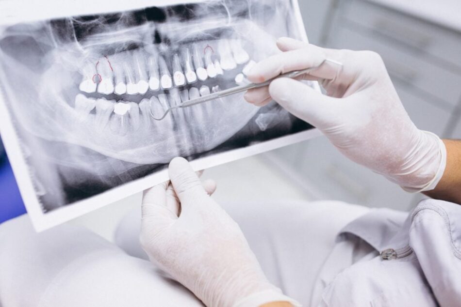Average Panoramic Dental X-Ray Cost Explained