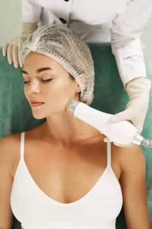 Revitalize Your Skin with RF Microneedling London – Advanced Treatments at Belle Clinic