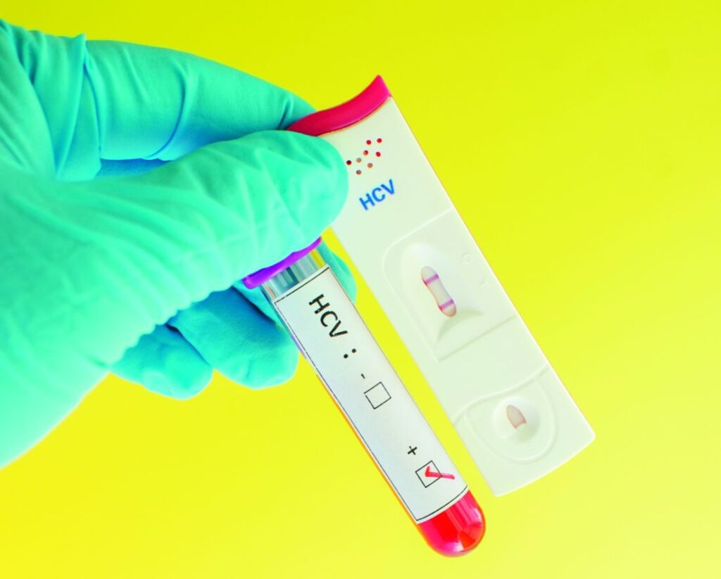 Hepatitis C Test