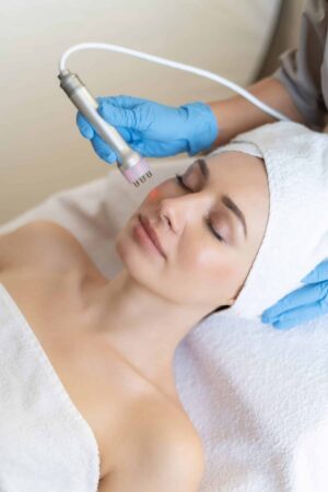 Revitalize Your Skin with Expert L5 RF Microneedling