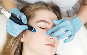 Can laser treatment in Dubai safely treat freckles or sun damage?