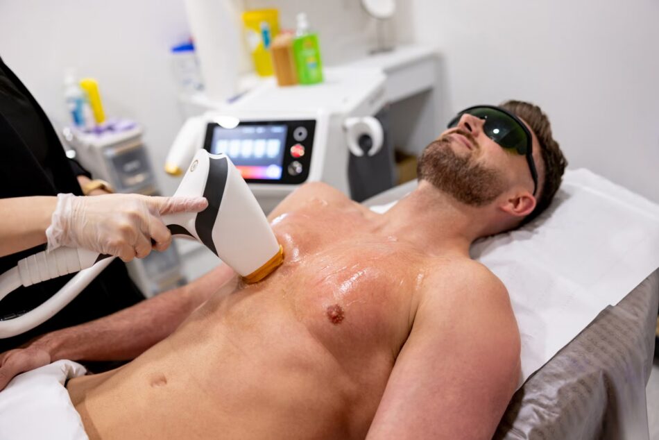 Male Laser Hair Removal