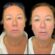 Best Aesthetic Clinics in Dubai for Botox and Fillers