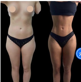 The Best Plastic Surgeon in Dubai for Non-Surgical Enhancements