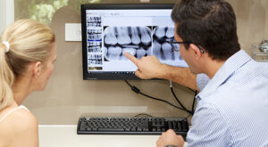 How to Prepare for Panoramic Dental X-Ray and Its Cost