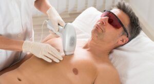 Male Laser Hair Removal