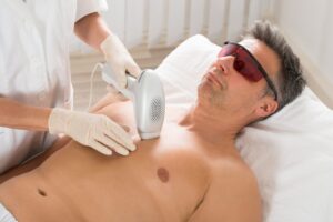 Does Skin Type Affect Male Laser Hair Removal Cost in Dubai?