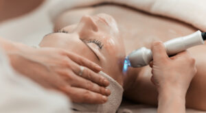 Laser Skincare Treatments