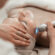 Laser Skincare Treatments