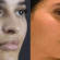 best rhinoplasty surgeon in dubai