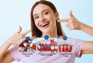 What new dental implant technologies are being used in Dubai in 2025?