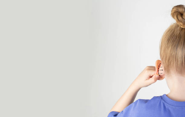 Trusted Ear Reshaping Surgery Riyadh