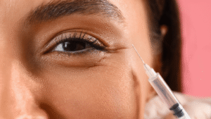 Safe and Effective Under Eye Fillers for a Rejuvenated Look