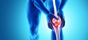 3D-Printed Hip And Knee Implant Market Advancing with smart Biomaterials Innovations