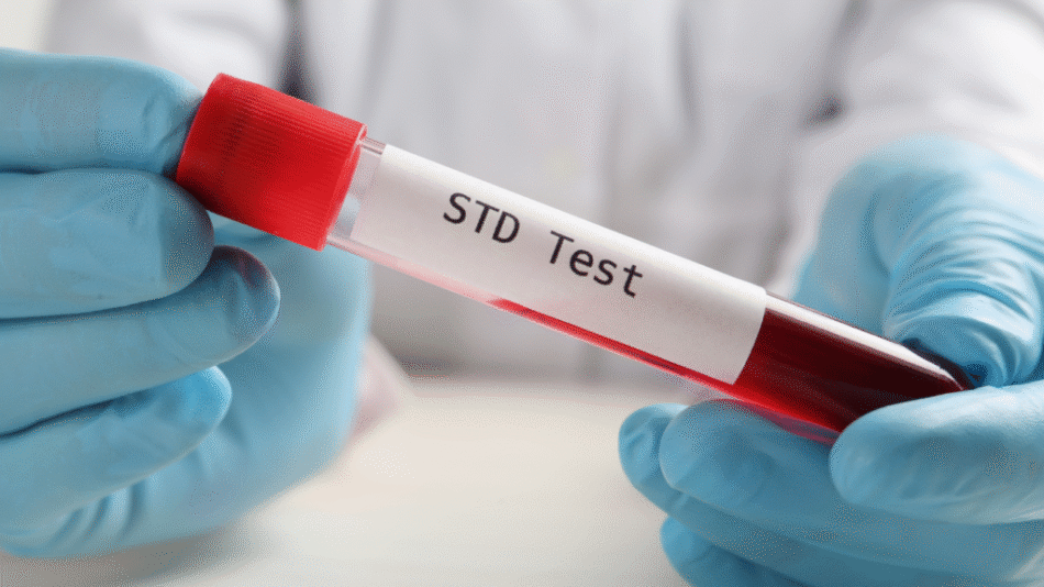 STD Test Guide: From Symptoms to Results
