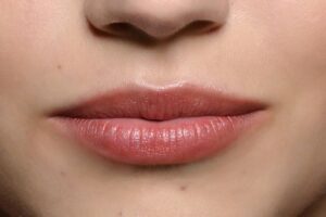 Pink Lips Laser Treatment for Safe, Even Tone and Quick Glow